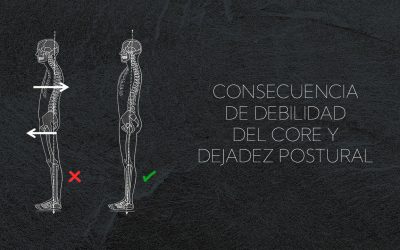 Postura Sway Back: la causa oculta de muchos dolores lumbares